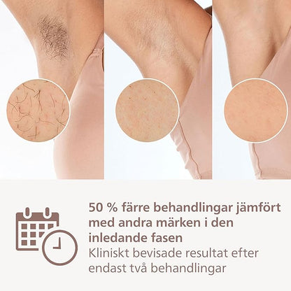 Philips Lumea 9000 Series BRI958/00 IPL hårborttagare